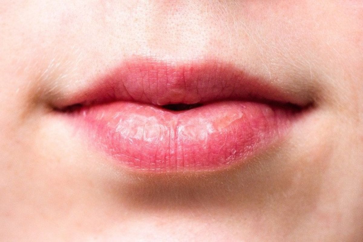 Benarkah minum dari sedotan bisa membuat bibir cepat keriput?